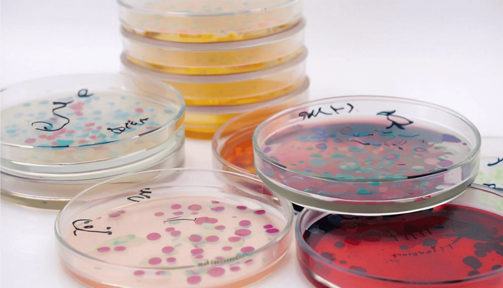 The Future of Microbial Testing: How Customized Culture Media is Changing the Game
